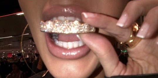 Le grill est sans nul doute l’une des modes les plus incongrues du Hip Hop. Le phénomène n’est pourtant pas nouveau.